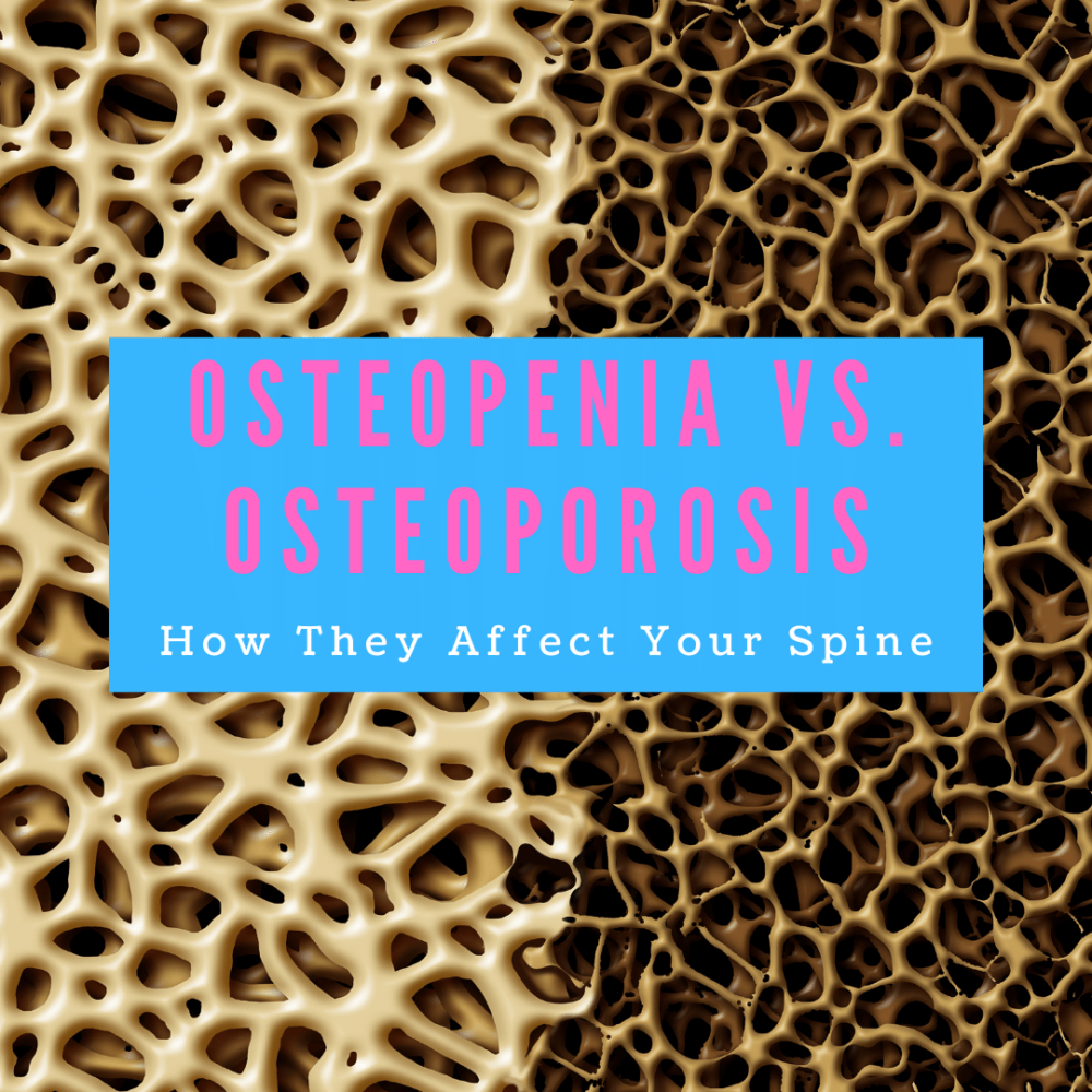 Ostopenia Vs Osteoporosis How They Affect Your Spine New Jersey