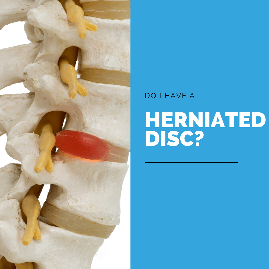 Do I have a herniated disc