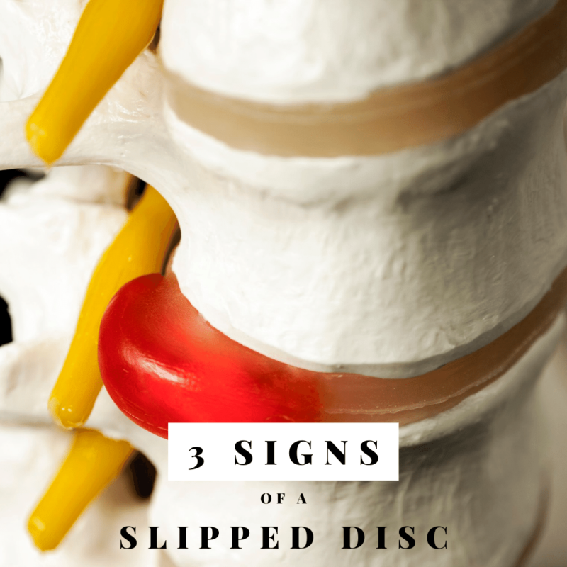 3 signs of a slipped disc
