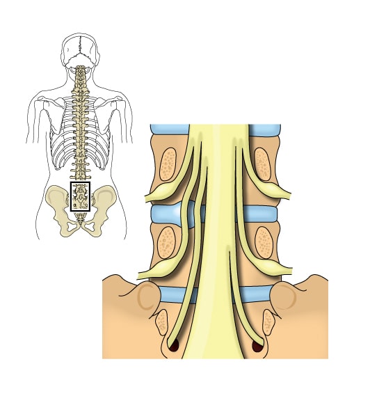 cauda equina nerve roots
