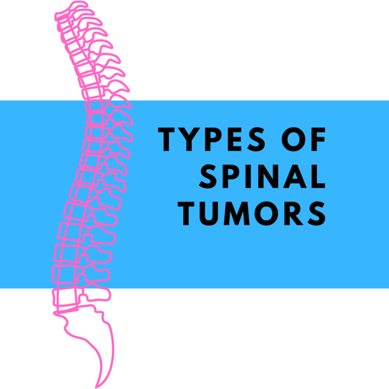 Types of Spinal Tumors
