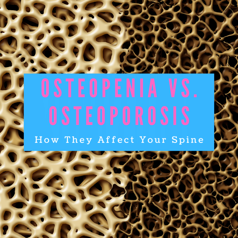 Osteopenia vs. Osteoporosis