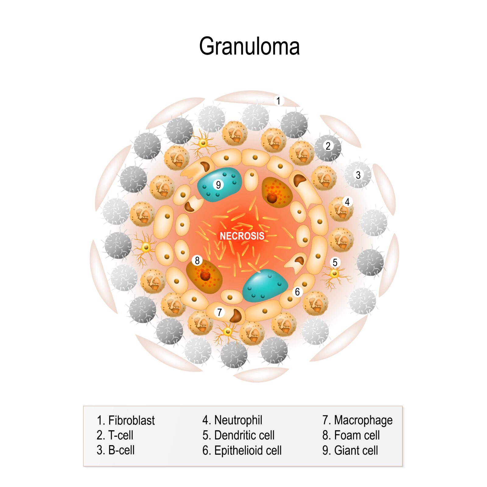 structure of a granuloma