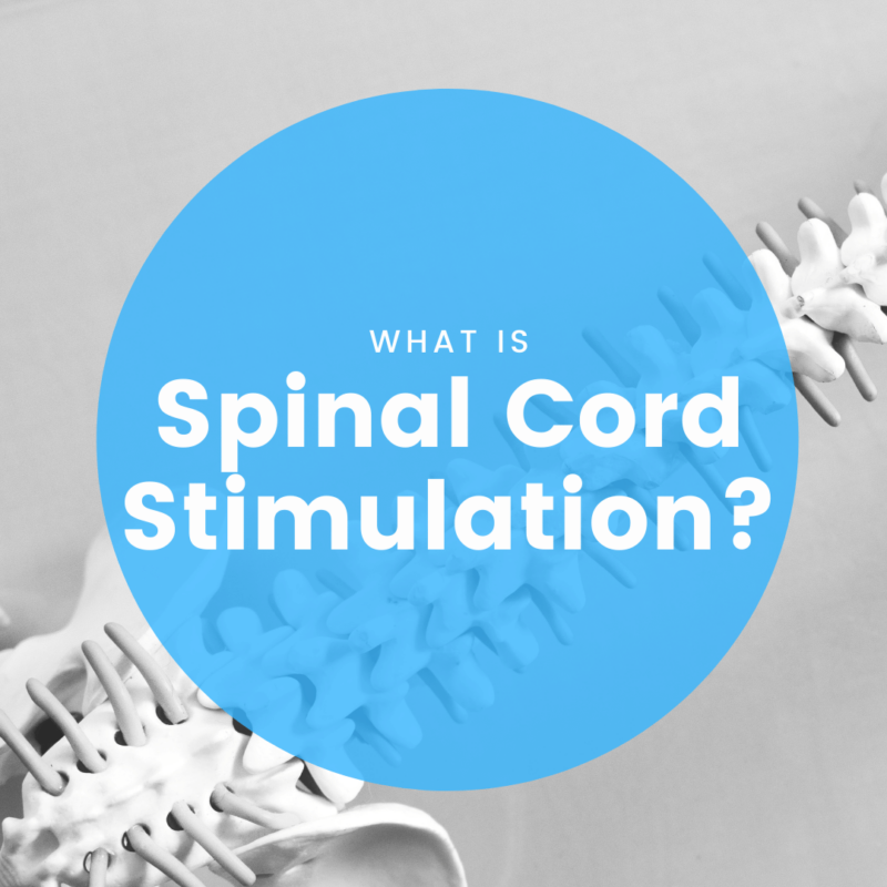 What is spinal cord stimulation