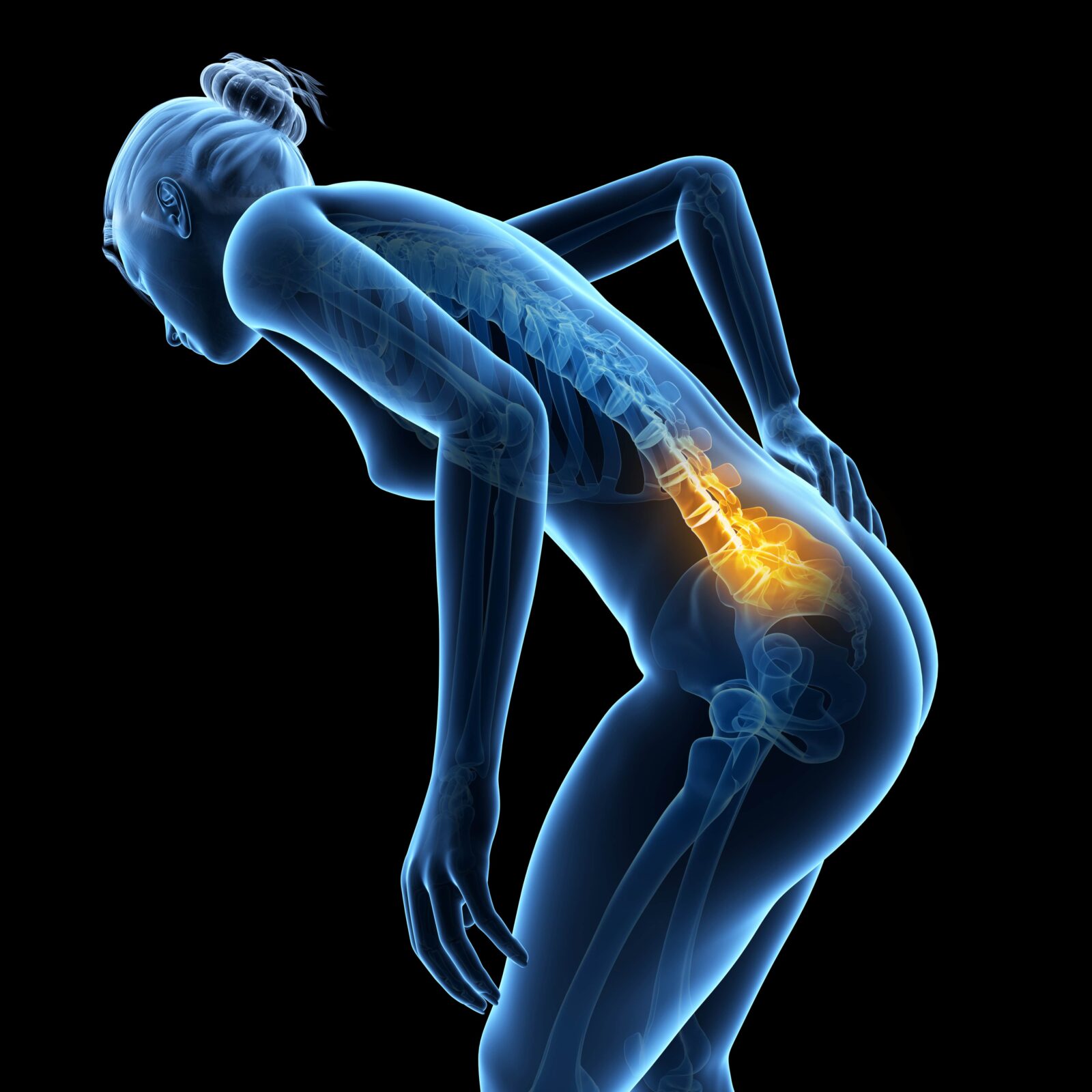 computerized image of a woman with back pain