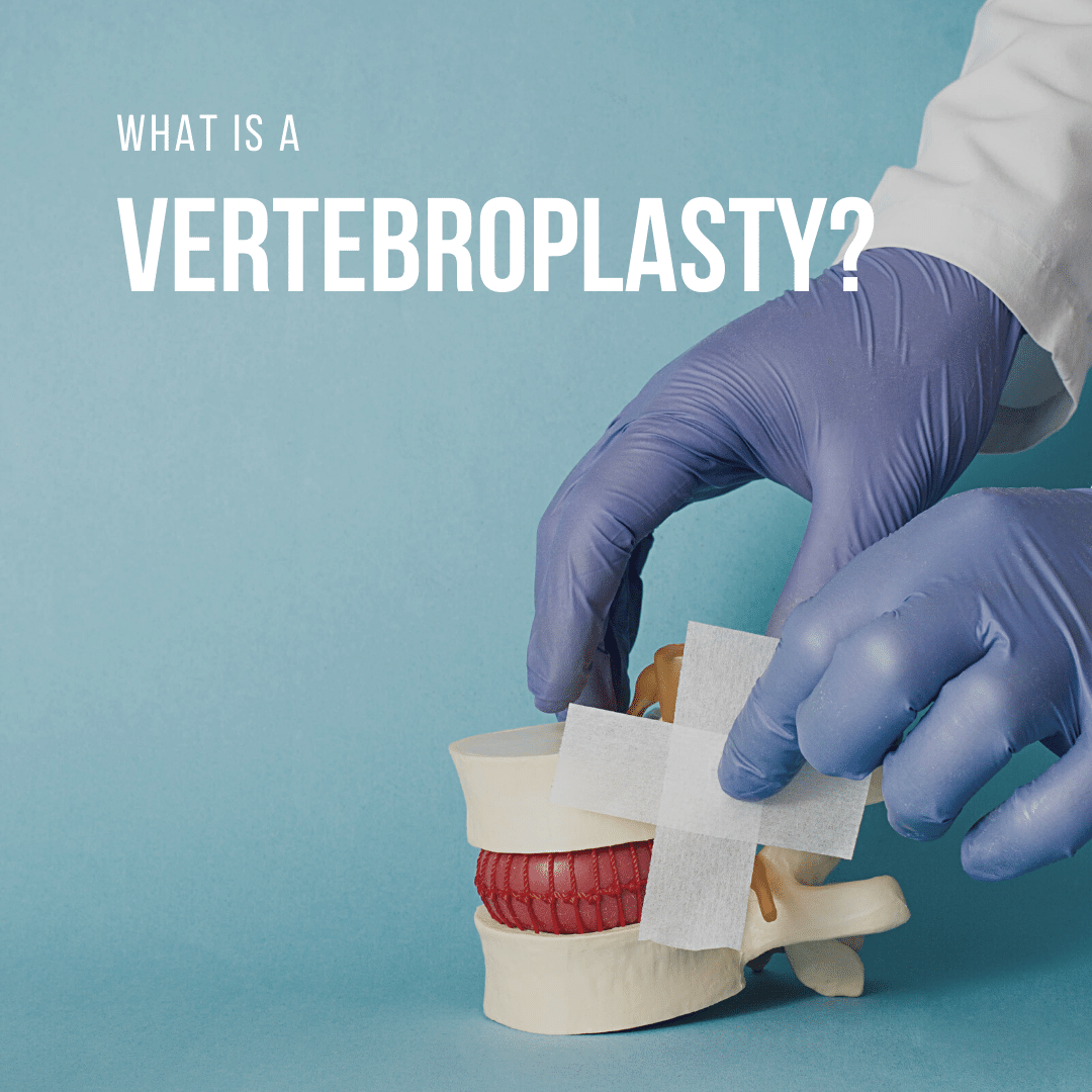 What is a vertebroplasty