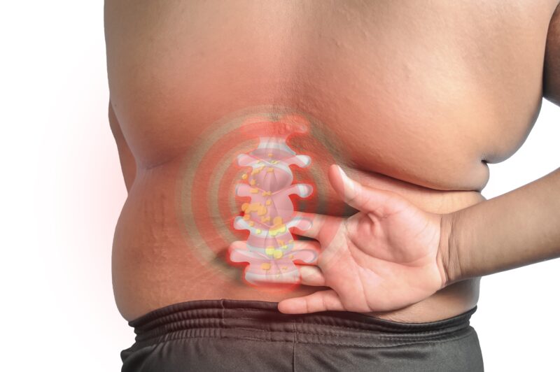 overweight man with lower back pain