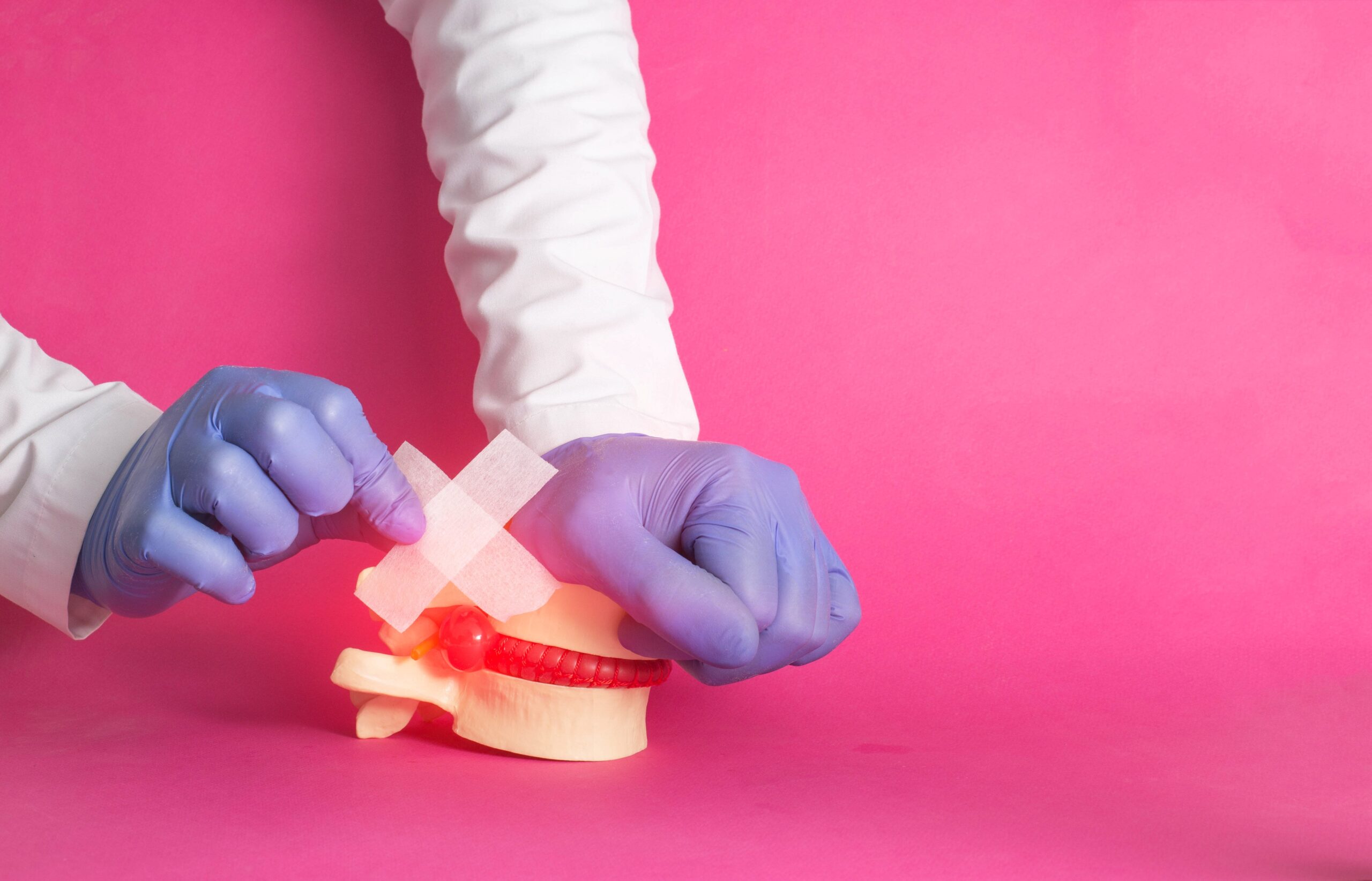 The doctor's hands are gluing a medical plaster on the released nucleus pulposus, intervertebral hernia, pink background. Spondylolisthesis and spondoarthrosis treatment concept, copy space for text