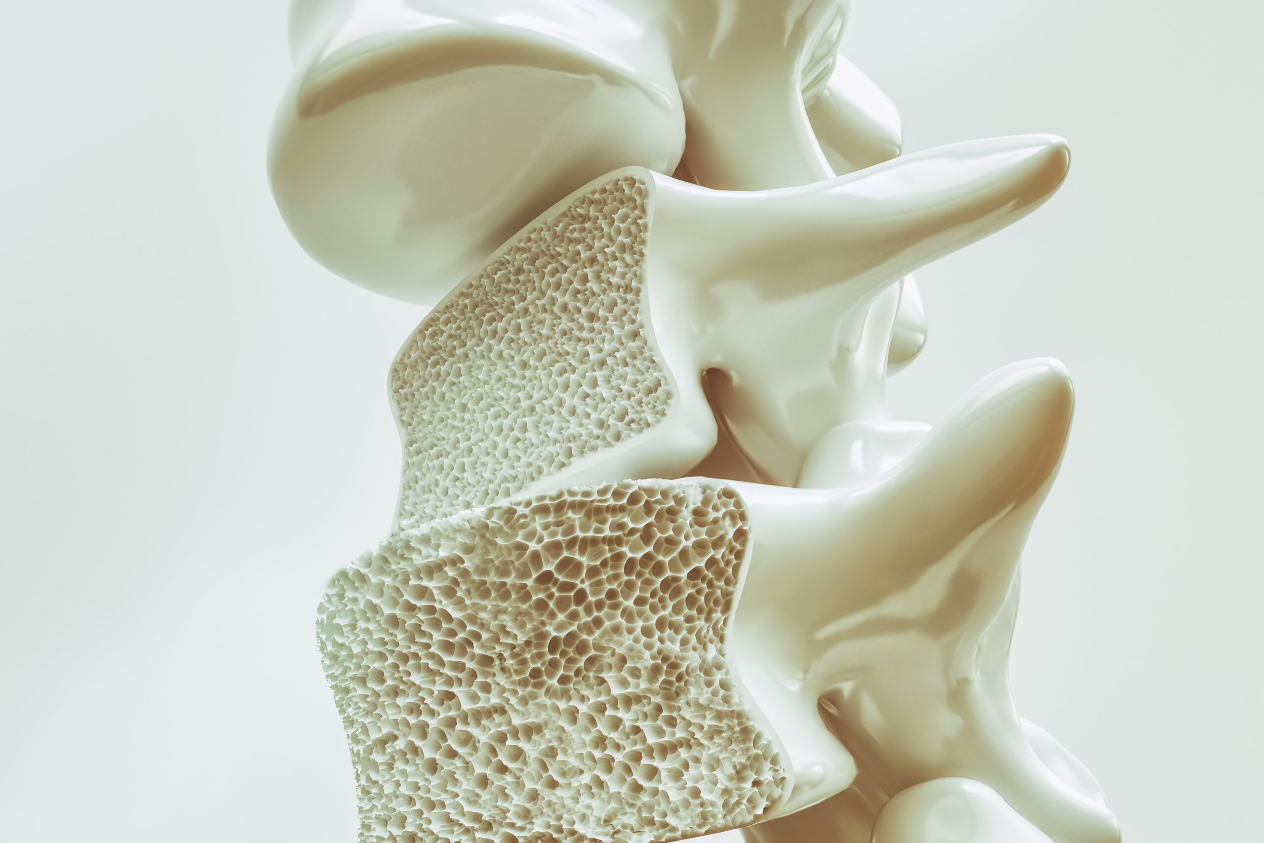 Osteoporosis on the spine - 3d rendering