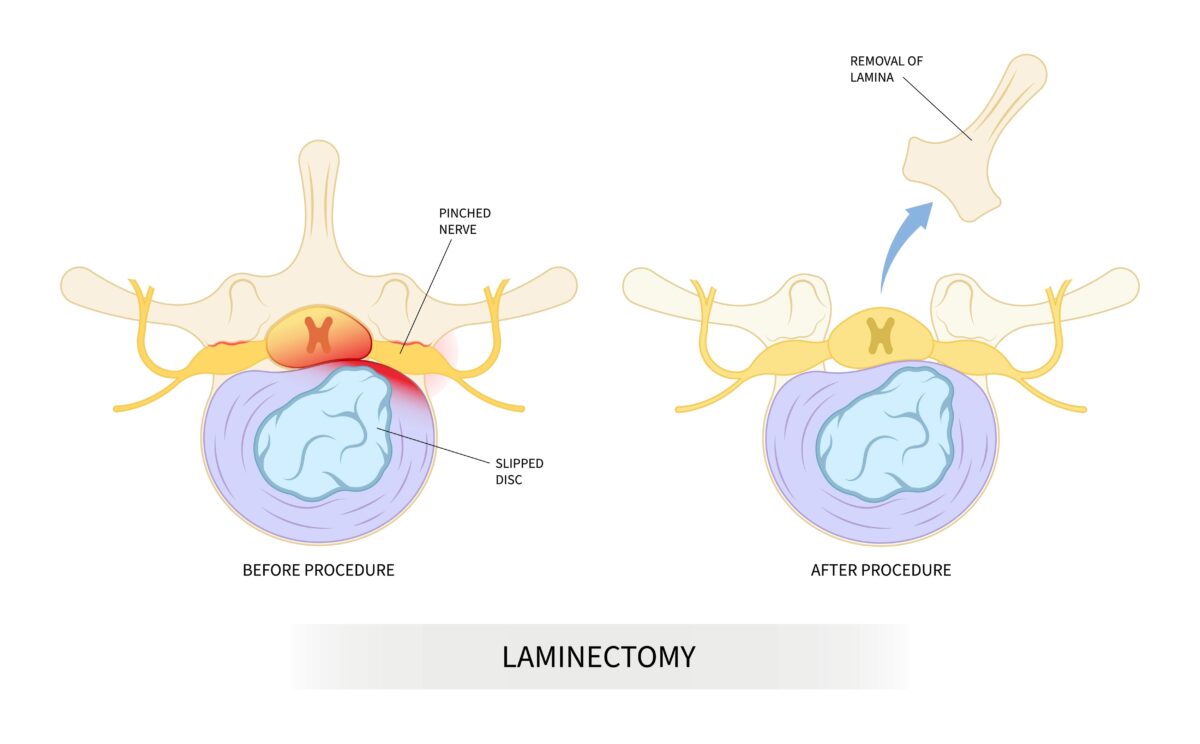 Common Spinal Surgeries And Their Uses New Jersey Comprehensive