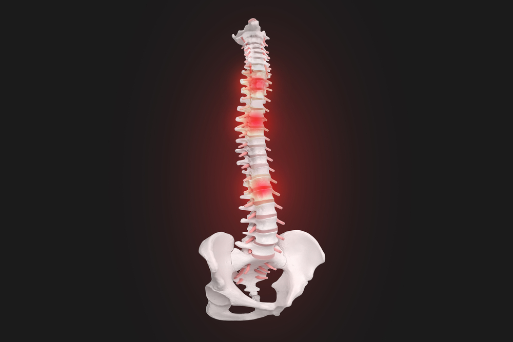 How to Prevent Spinal Degeneration as You Age