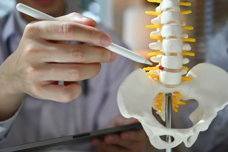 mold of a spine