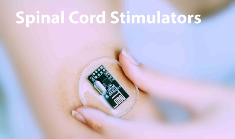Spinal cord stimulators: Manage chronic pain by delivering electrical signals to the spinal cord, interfering with pain signals.
