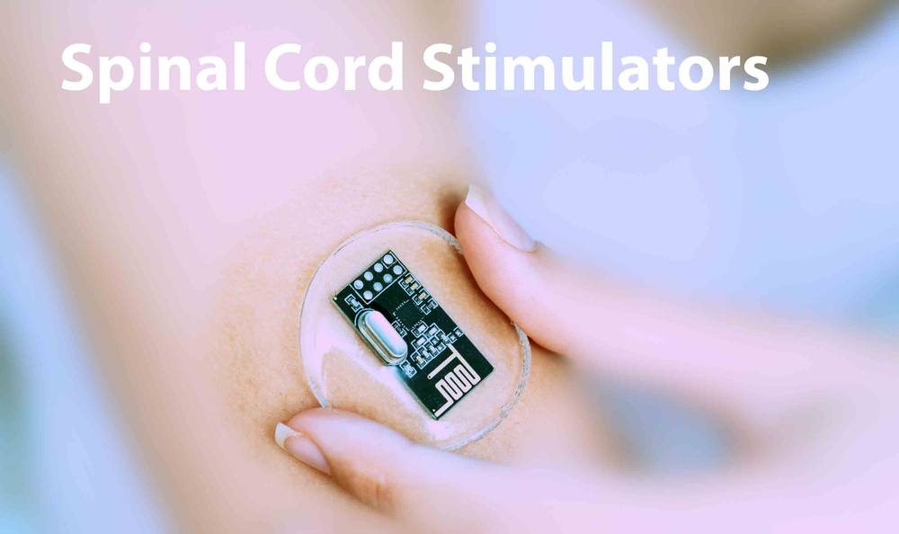 Spinal cord stimulators: Manage chronic pain by delivering electrical signals to the spinal cord, interfering with pain signals.