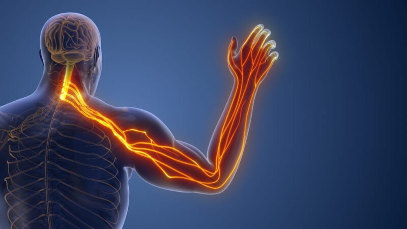 Compressed Cervical Nerve Leading to Radiating Pain 3d illustration