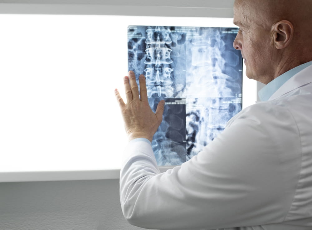 doctor examining patients Spine x-ray and MRI scans. Diagnosis of diseases of the spine, injuries of the back and cervical spine