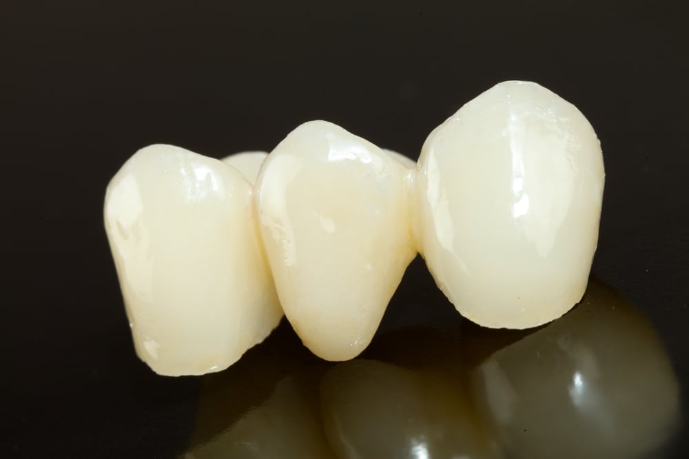 dental crown on isolated background