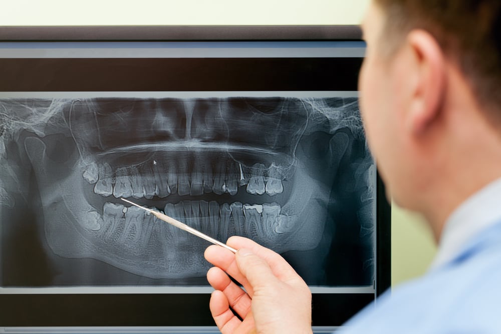 doctor examining dental x-rays