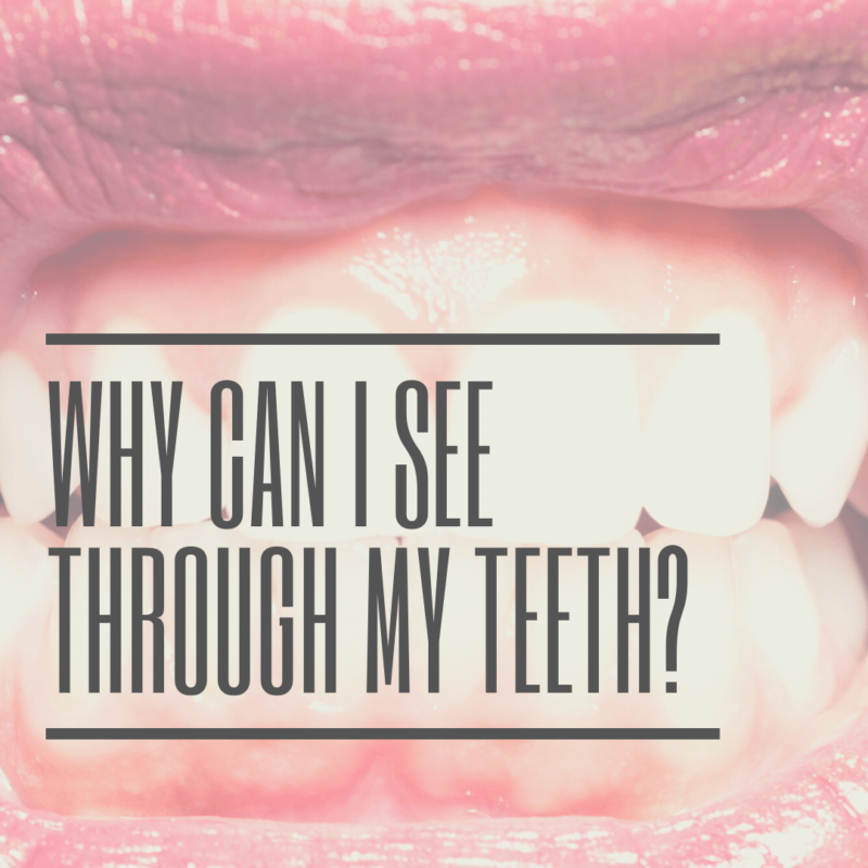 why can I see through my teeth