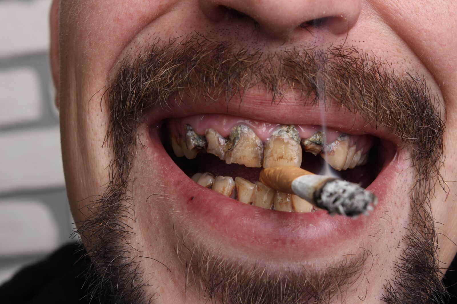 man smoking with stained teeth