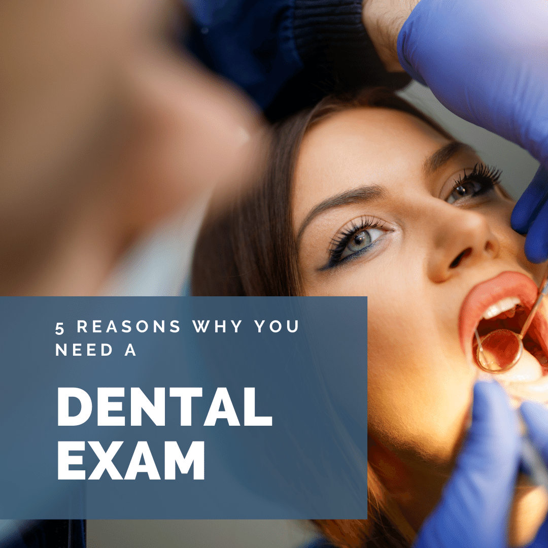 5 Reasons Why You Need a dental exam