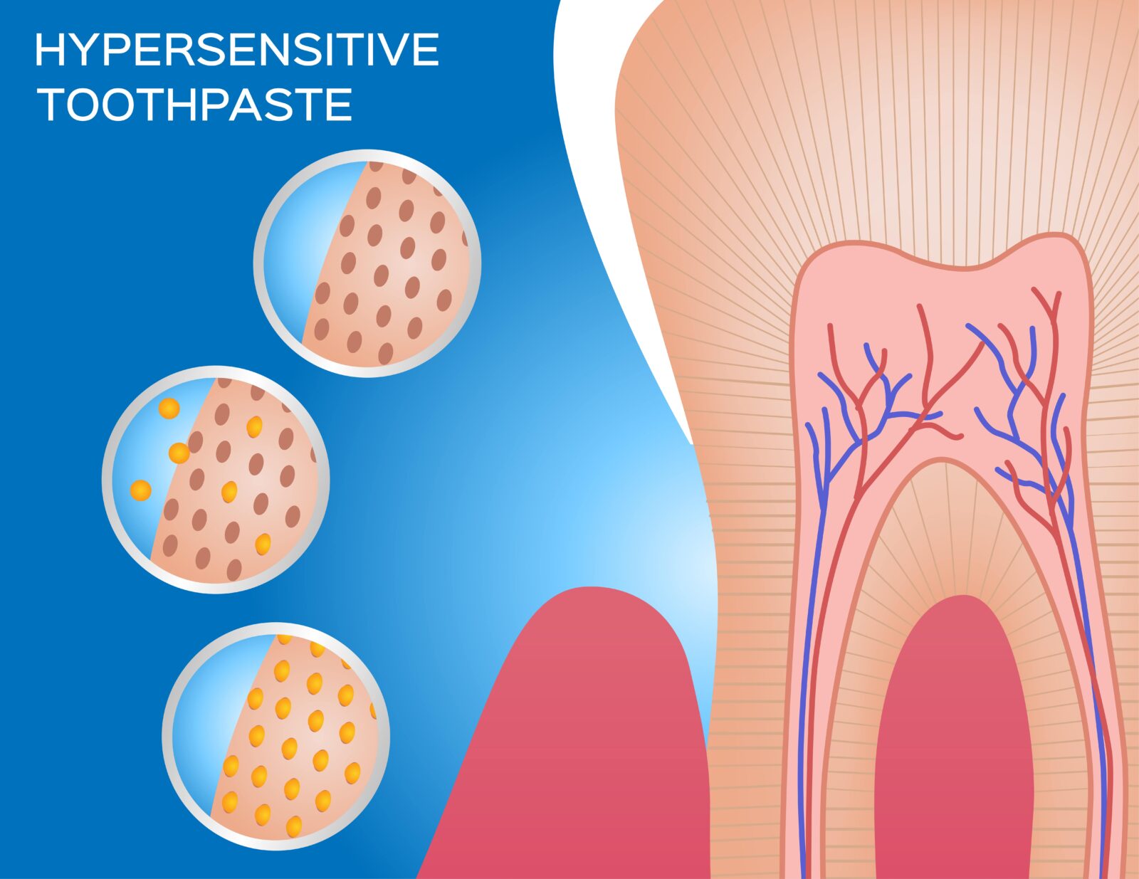 how desensitizing toothpaste works