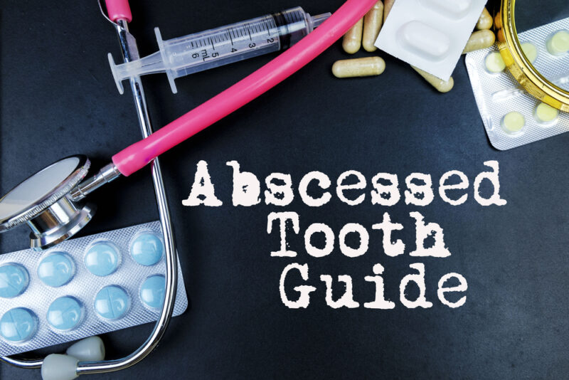 Abscessed Tooth Guide word, medical term word with medical concepts in blackboard and medical equipment.