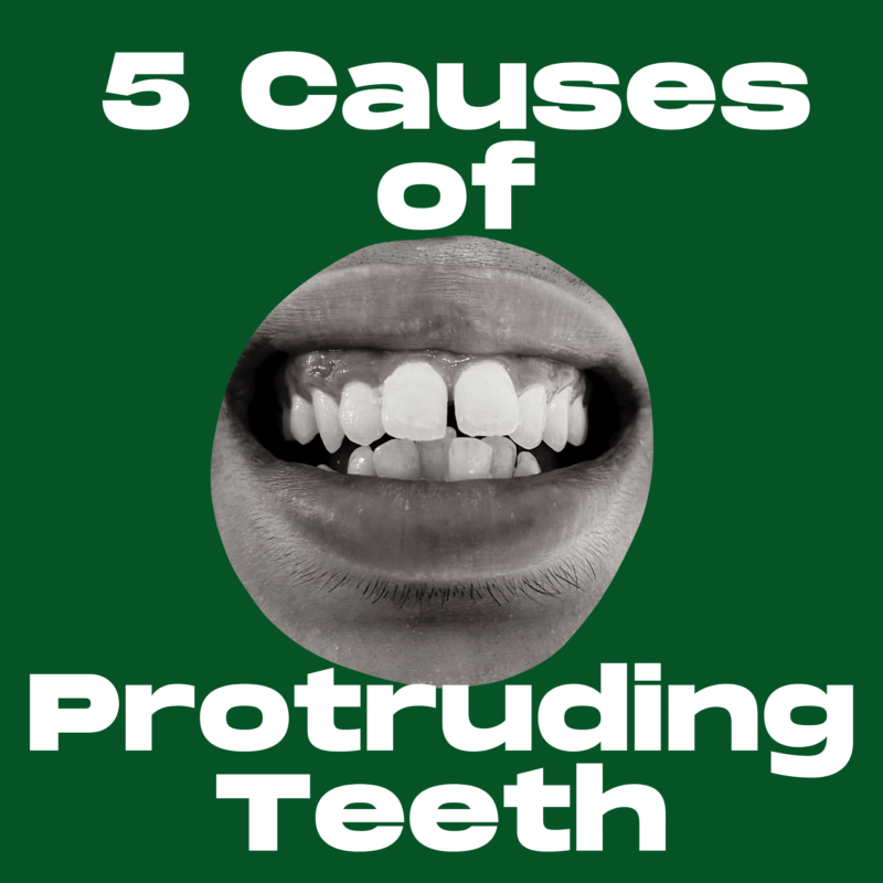 5 Causes of Protruding Teeth
