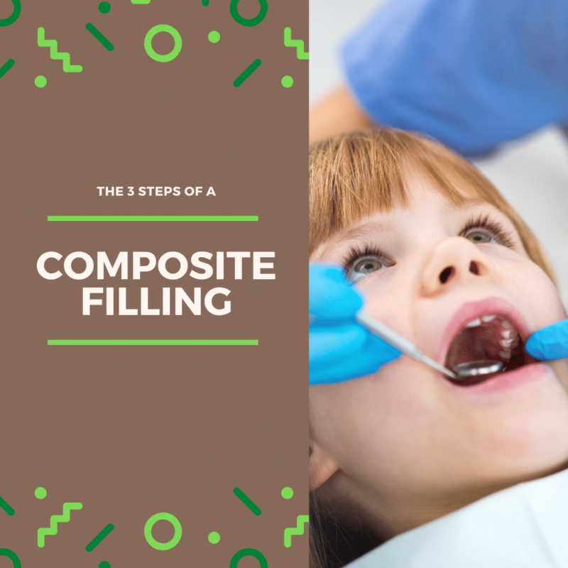 The 3 steps of a composite filling