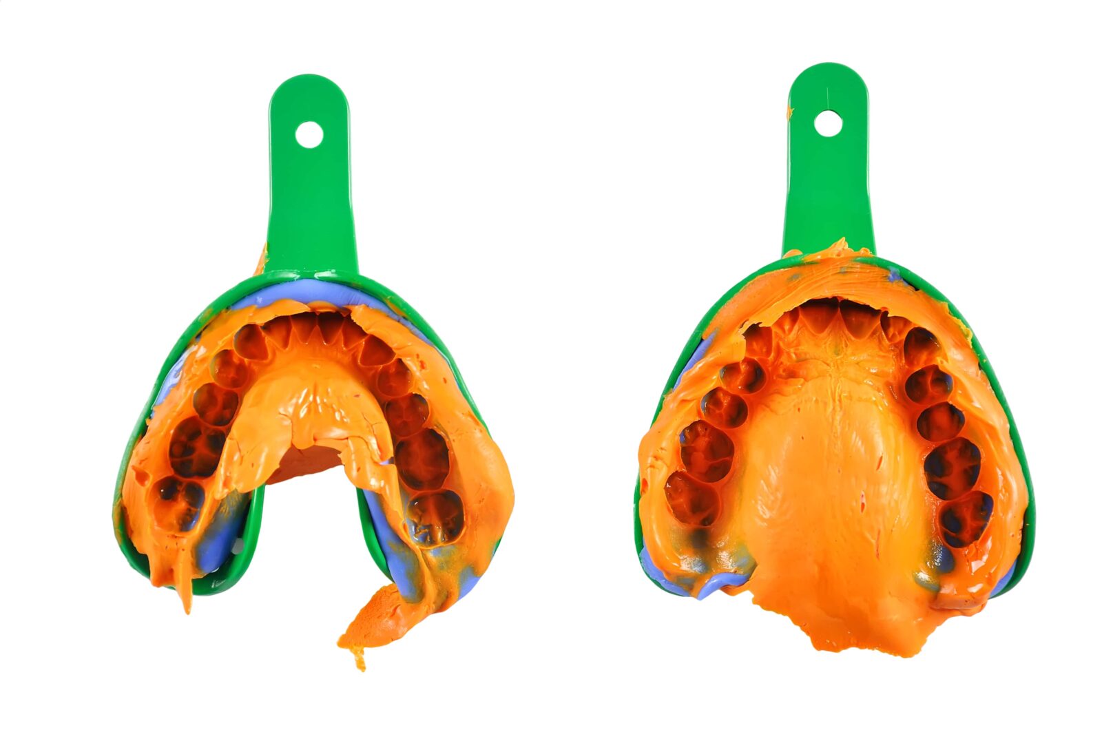 dental impression trays