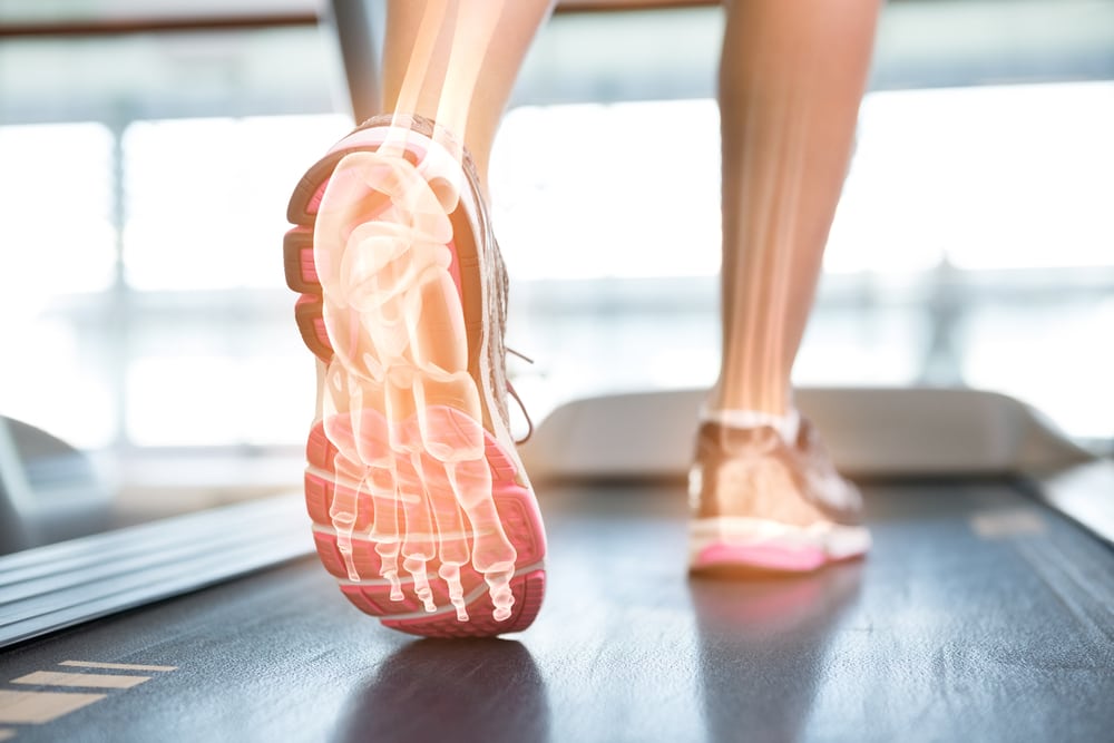 x ray of feet running on treadmill