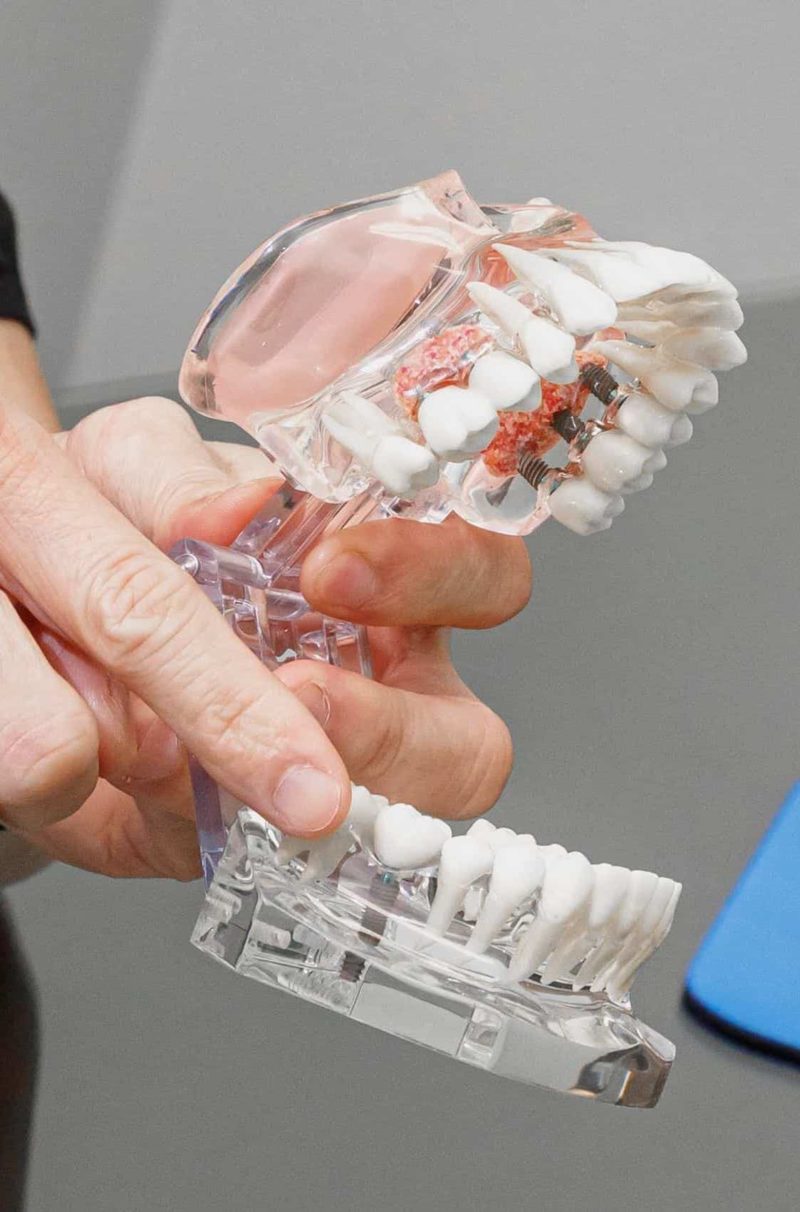 high-quality 3d model of teeth