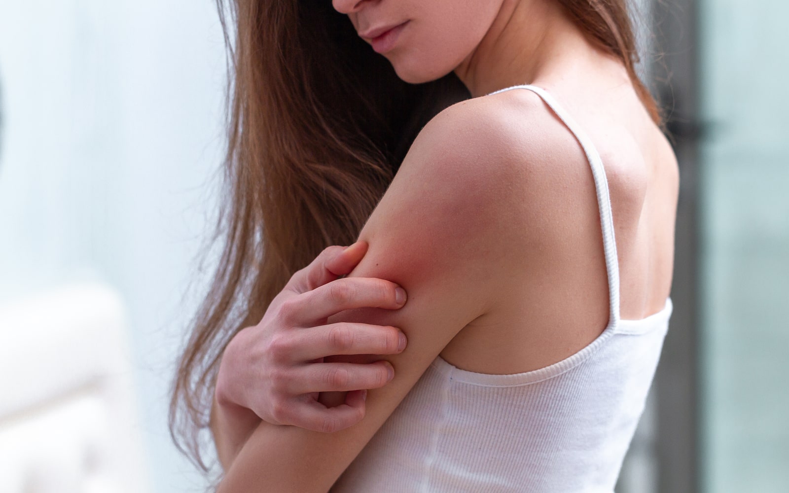 Woman with shoulder rash