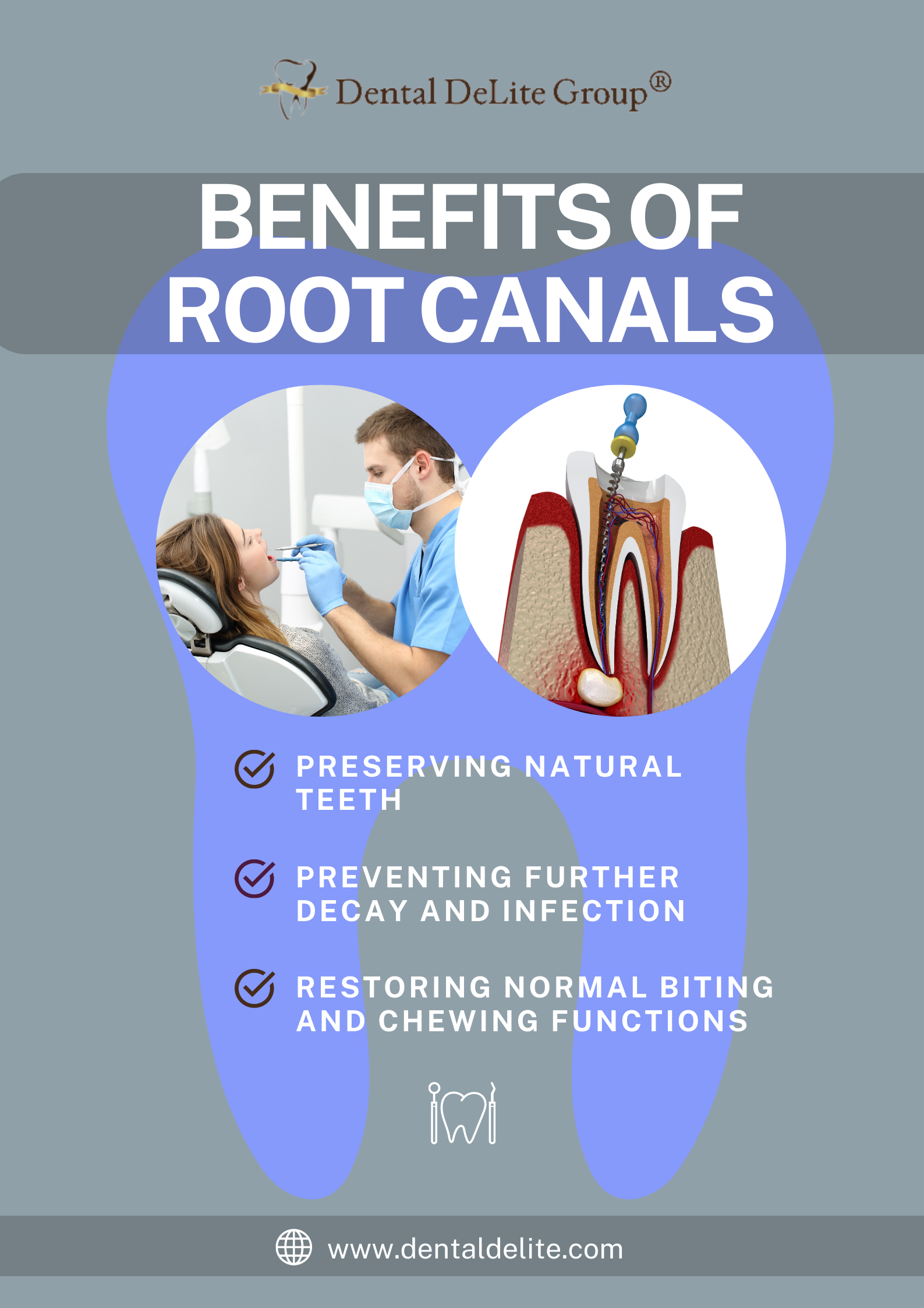 Benefits of Root Canals 