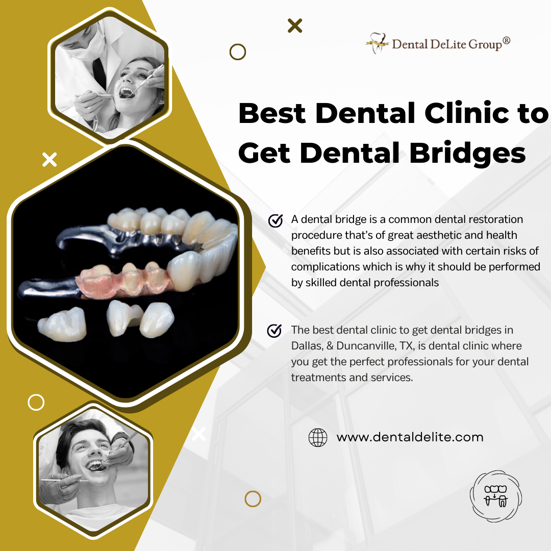 Best Dental Clinic to Get Dental Bridges in Dallas, & Duncanville, TX