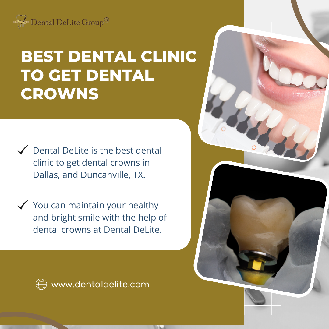 Get a Brighter, Healthier Smile with Dental Crowns in Dallas and Duncanville, TX 4 used to demonstrate the concept of Get a Brighter, Healthier Smile with Dental Crowns in Dallas and Duncanville, TX Best Dental Clinic to Get Dental crowns in Dallas, and Duncanville, TX