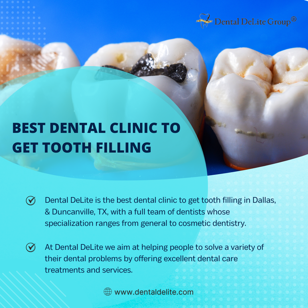  Best Dental Clinic to Get Tooth filling in Dallas and Duncanville, TX