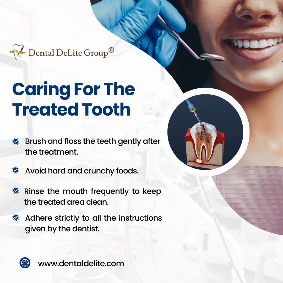 The Importance of Root Canals in Preserving Your Natural Teeth - Dallas & Duncanville, Tx 3 used to demonstrate the concept of The Importance of Root Canals in Preserving Your Natural Teeth - Dallas & Duncanville, Tx Caring For The Treated Tooth