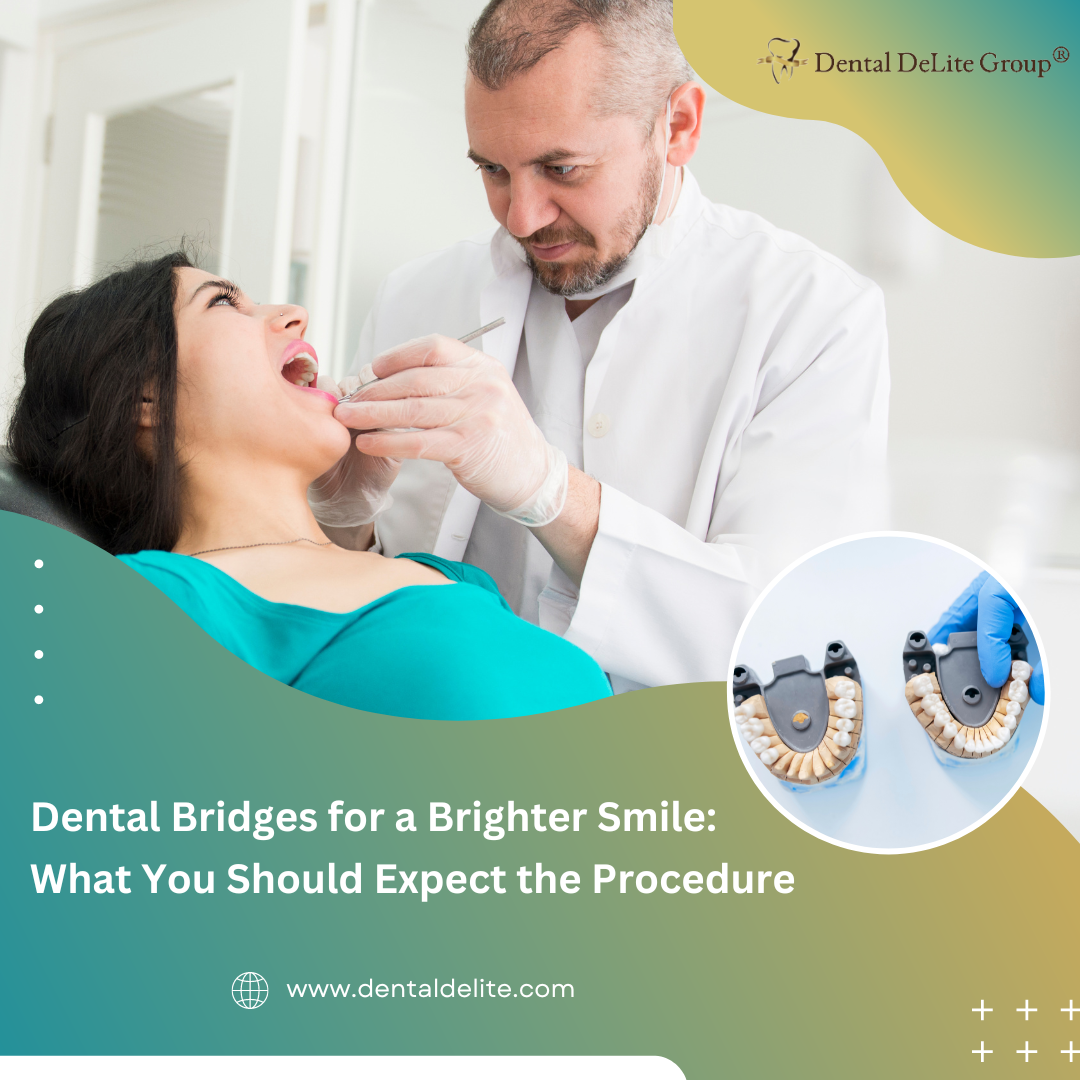 Dental Bridges for a Brighter Smile What You Should Expect the Procedure