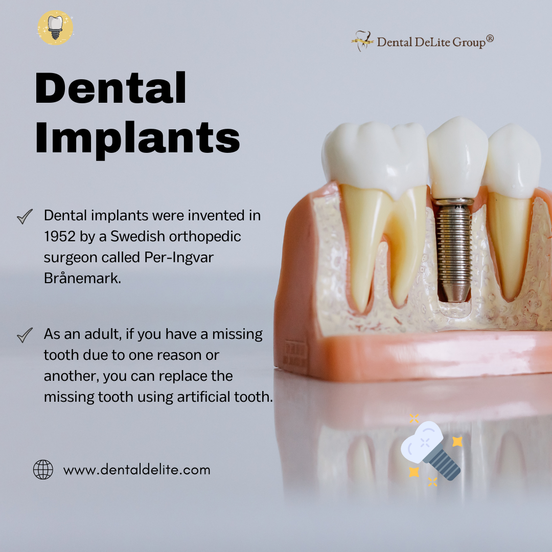 Dental Implants in Dallas, & Duncanville, TX