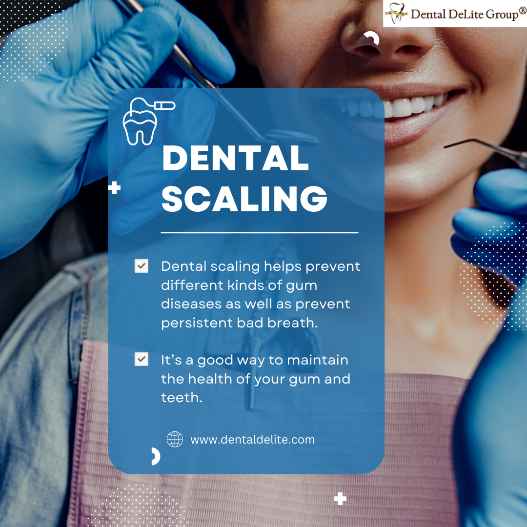 Dental Scaling in Dallas and Duncanville, TX