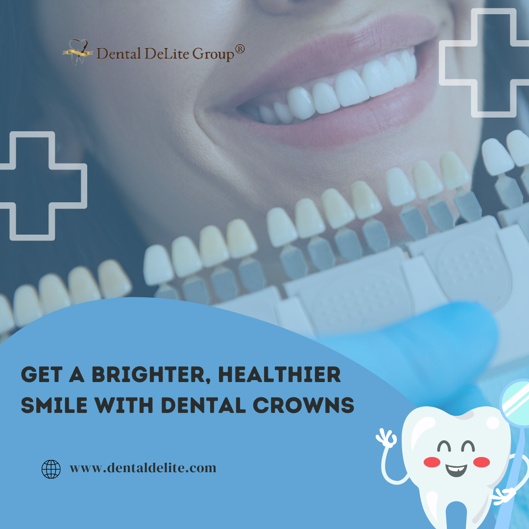 Get a Brighter, Healthier Smile with Dental Crowns in Dallas and Duncanville, TX