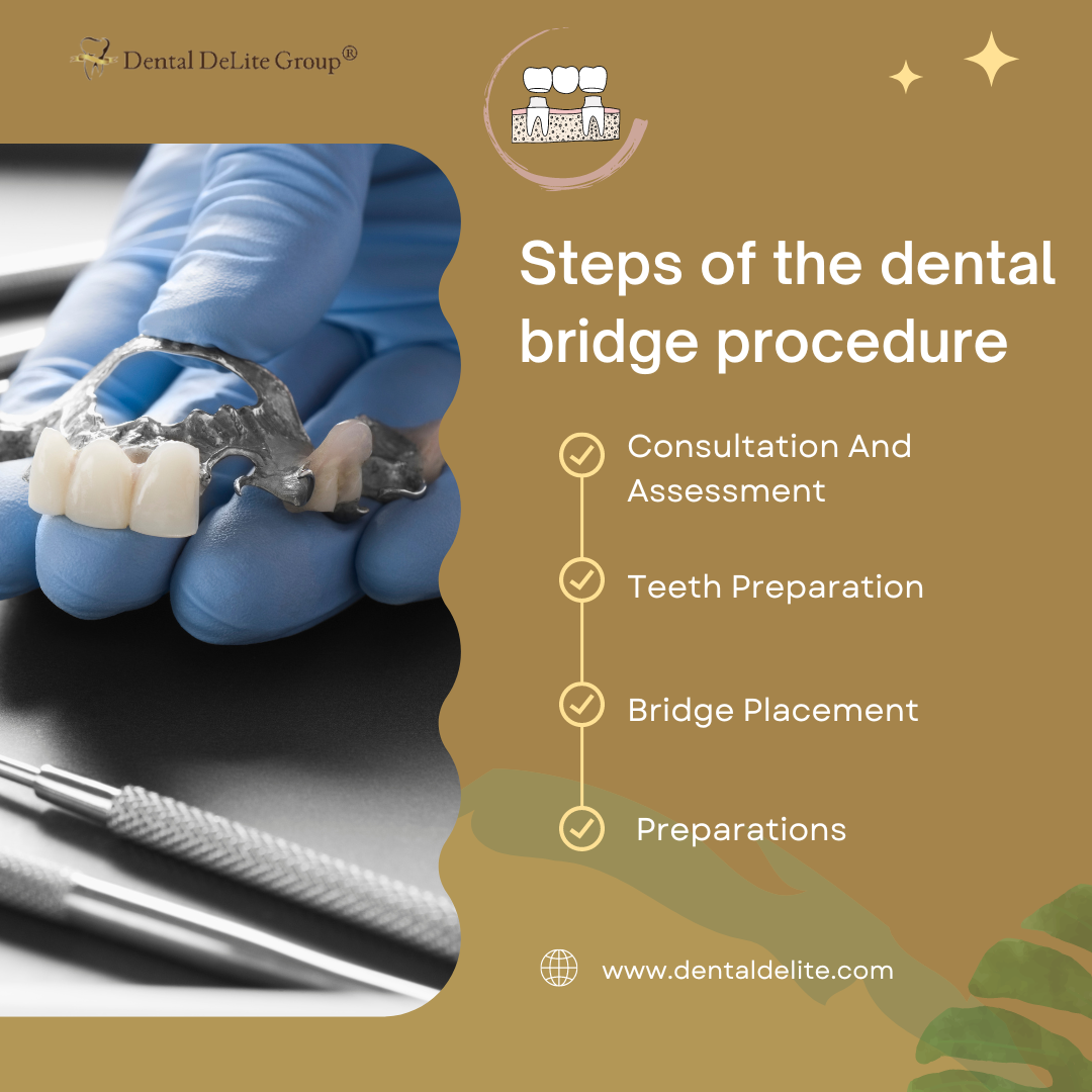 Steps of the dental bridge procedure