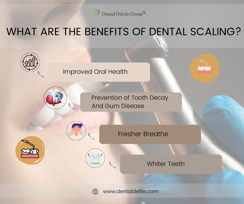 What Are The Benefits of Dental Scaling