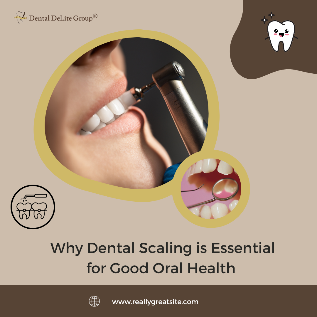 Why Dental Scaling is Essential for Good Oral Health in Dallas and Duncanville, TX