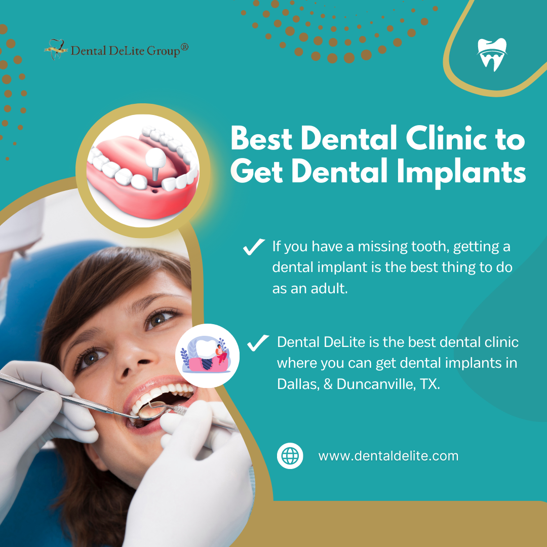 Best Dental Clinic to Get Dental Implants in Dallas, &  Duncanville, TX