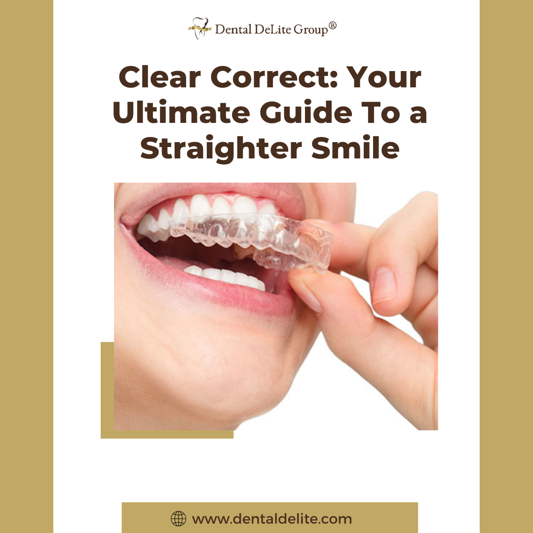 Clear Correct in Dallas & Duncanville, TX Your Ultimate Guide To a Straighter Smile