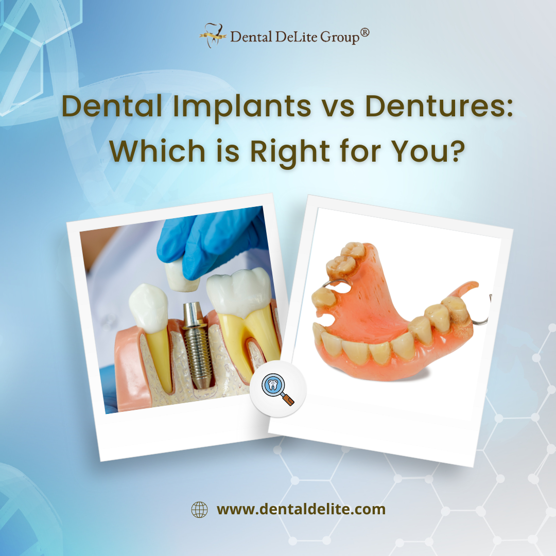 Dental Implants vs Dentures Which is Right for You in Dallas & Duncanville, TX