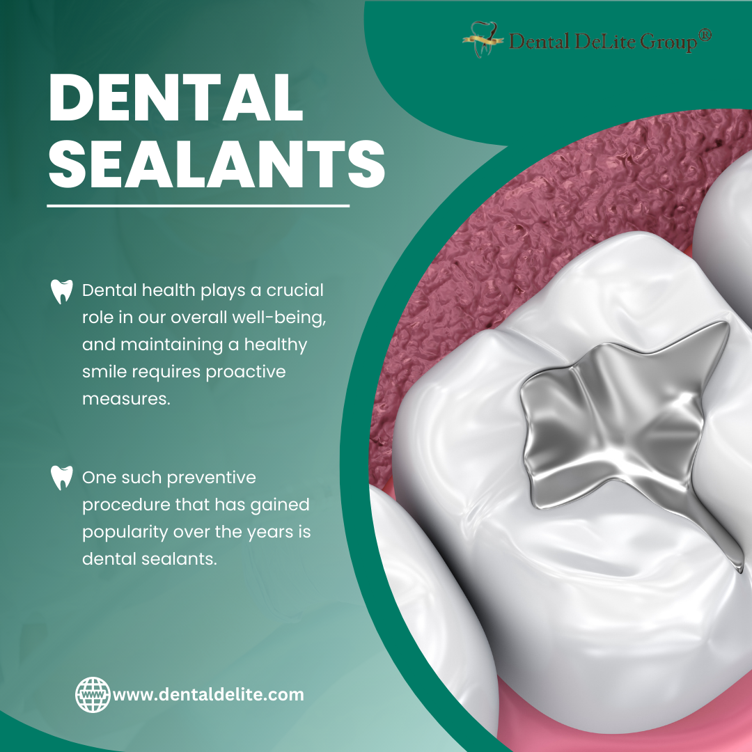 Dental Sealants in Dallas, and Duncanville, TX