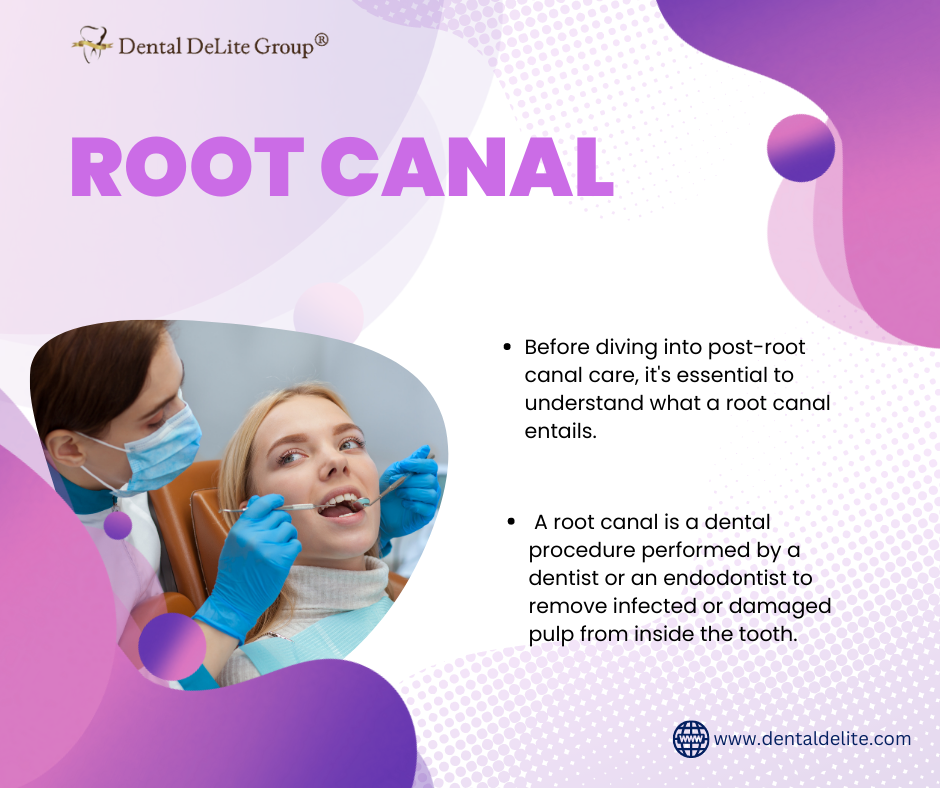 Understanding Root Canal